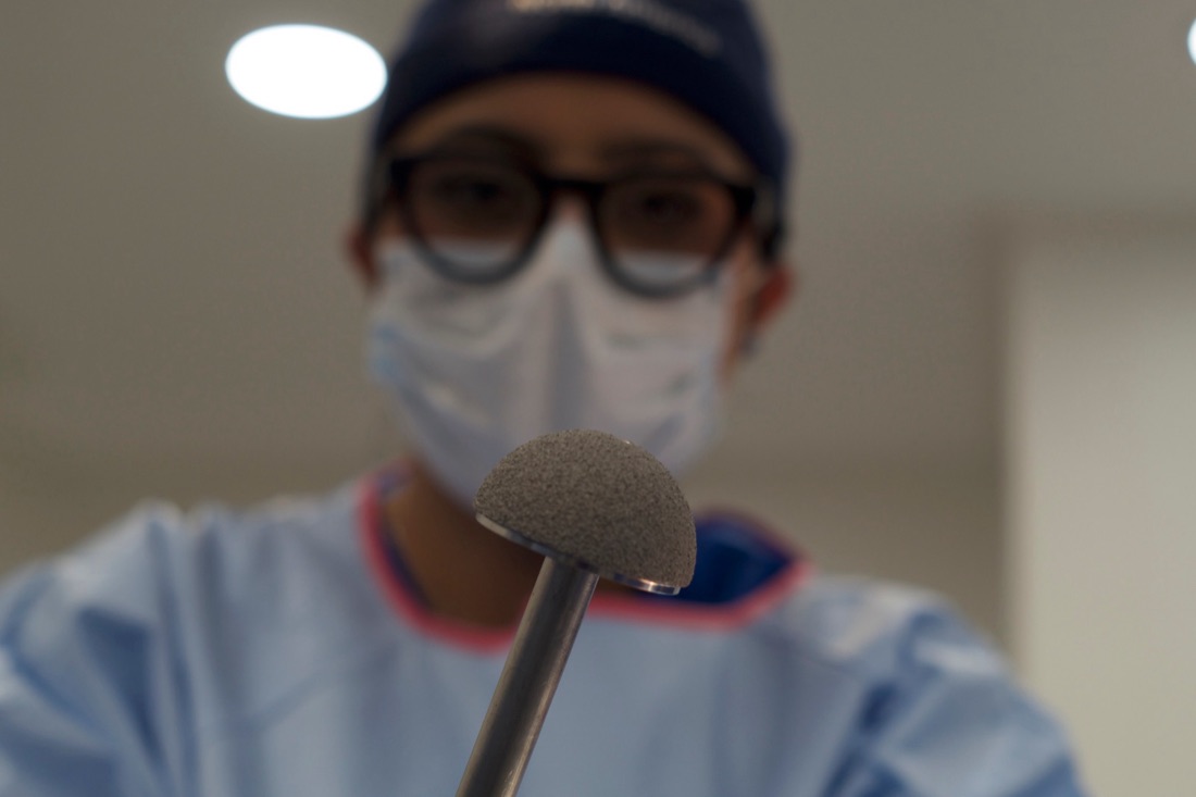 Componente acetabular de una prótesis de cadera sostenido frente a la Dra. Mariana López